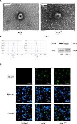 Endothelial exosomes work as a functional mediator to activate macrophages